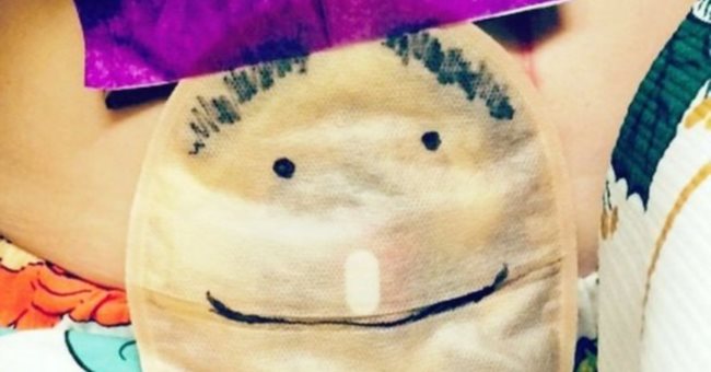 証明手術不羞愧，女生命名造口袋