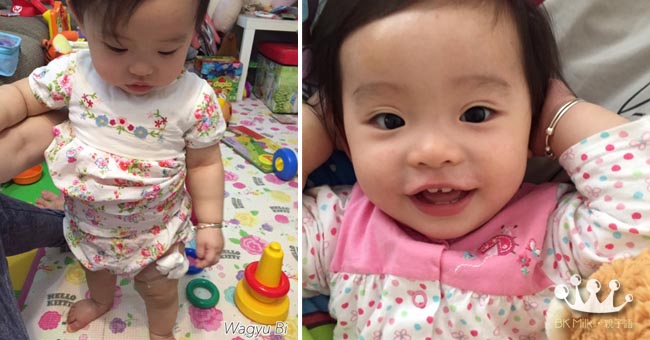 1歲健康院檢查+打針