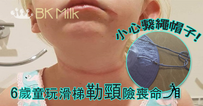 女兒給帽子勒頸，媽媽忠告要小心