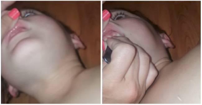 指甲插牙肉!媽媽警告:孩子咬指甲風險