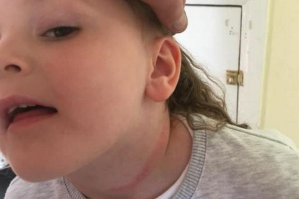 爸爸的危險警告：女兒的頸給窗簾繩纏住了…