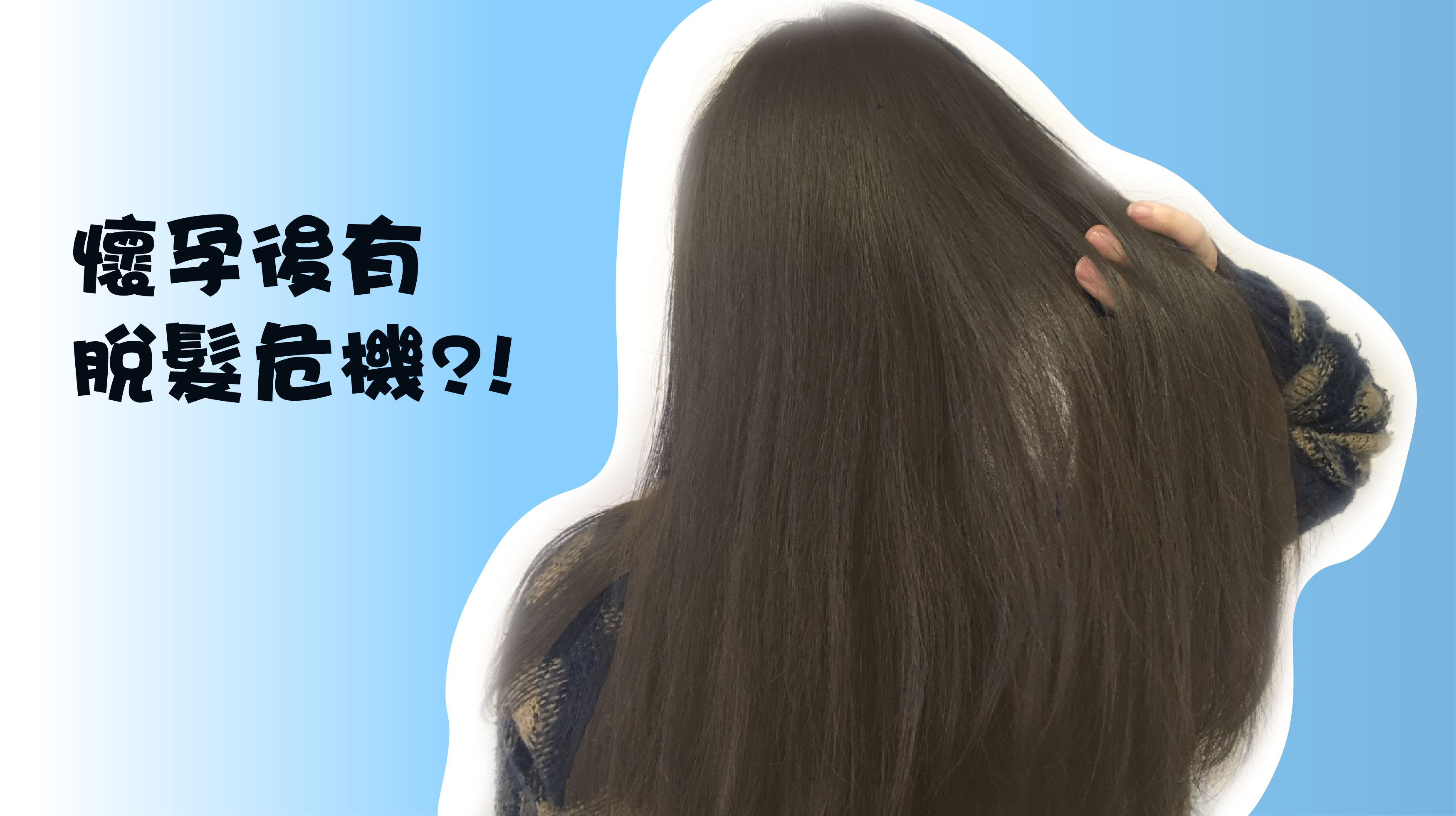 【女士脫髮危機知多點】懷孕後有機會脫髮？！