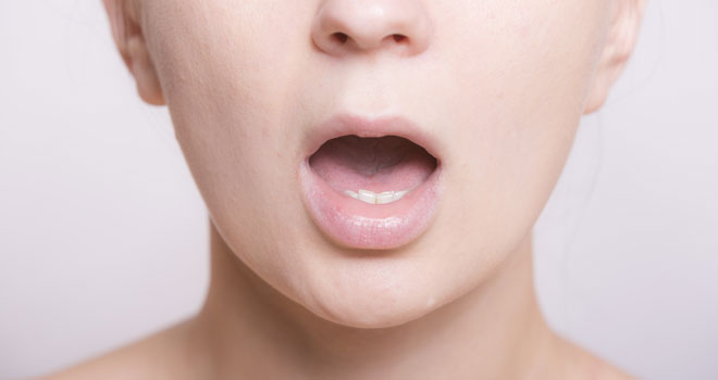皰疹病毒「爛嘴」=性病？