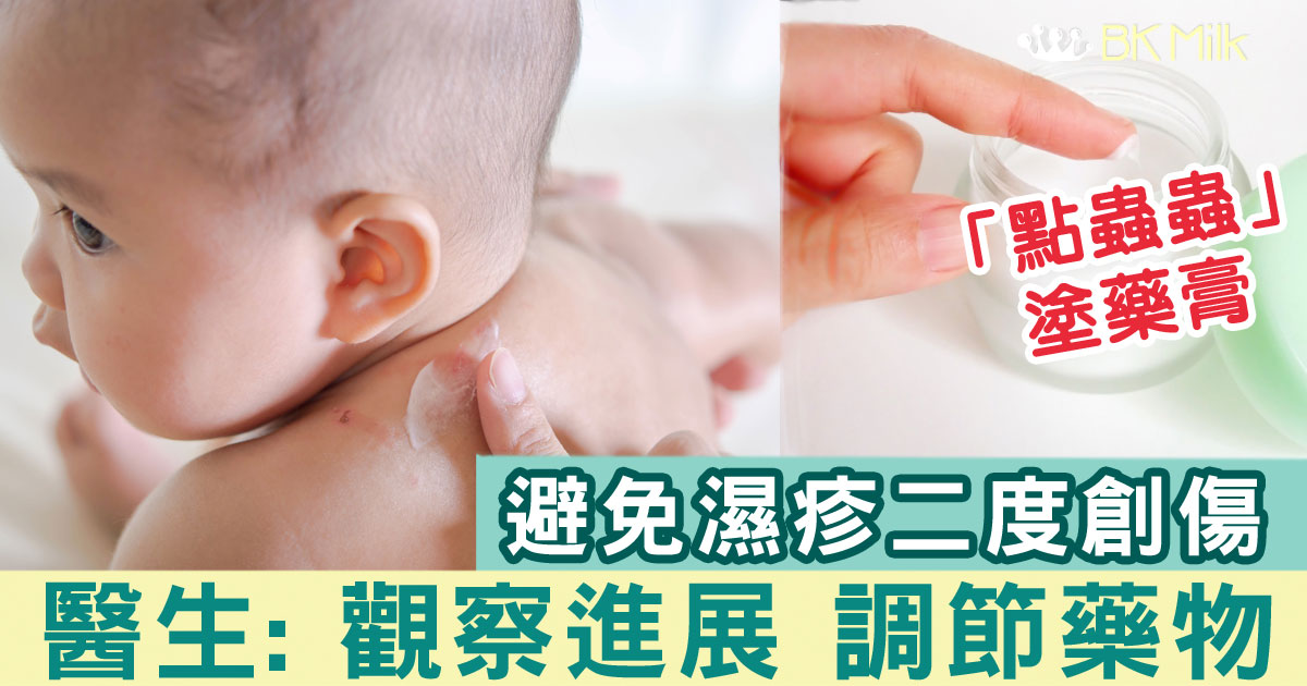 濕疹反覆發作 醫生: 「點蟲蟲」塗藥膏 阻抓癢致二度創傷