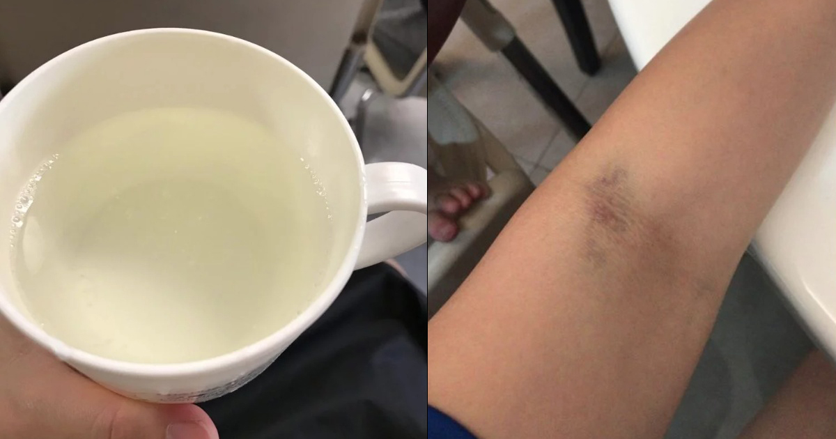 令準媽媽聞風喪膽的飲糖水測試 （妊娠糖尿測試）