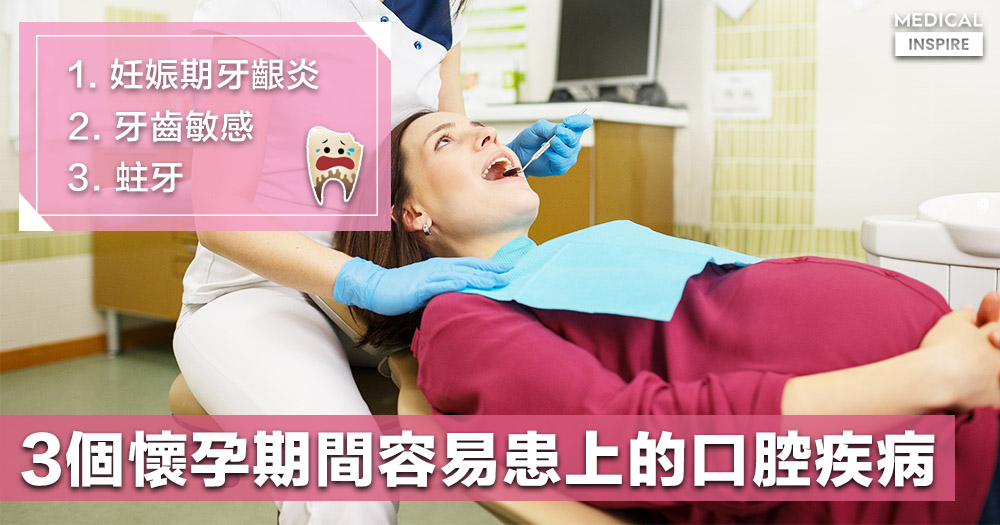【婦女錦囊】懷孕期間容易患上口腔疾病？了解成因及早預防