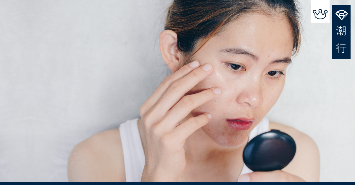 「熊貓」出沒注意！黑眼圈總是困擾著你