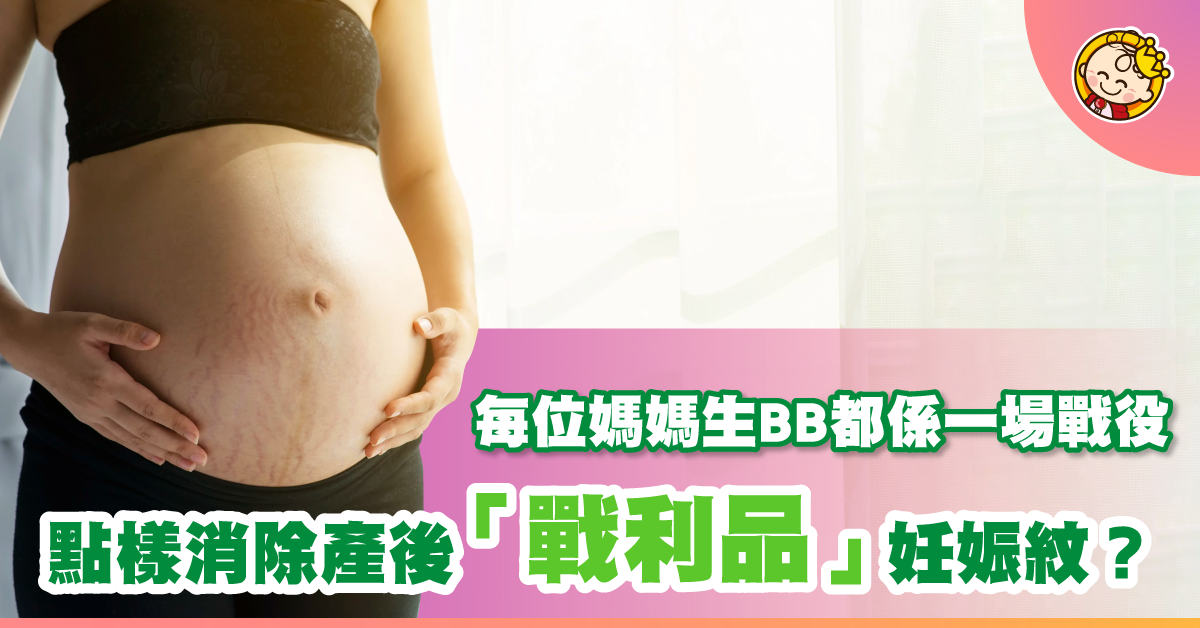產後妊娠紋有冇得消退？普通科醫生話：預防勝於治療