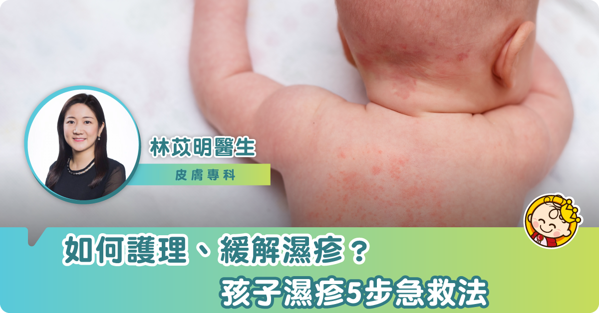 如何護理和緩解濕疹？孩子濕疹5步急救法