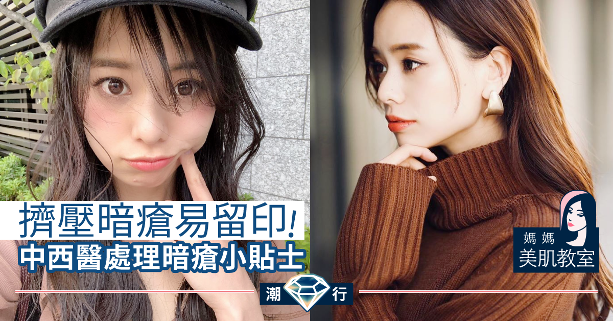 【媽媽美肌教室】爆瘡仲用手擠?中西醫教你處理暗瘡小貼士