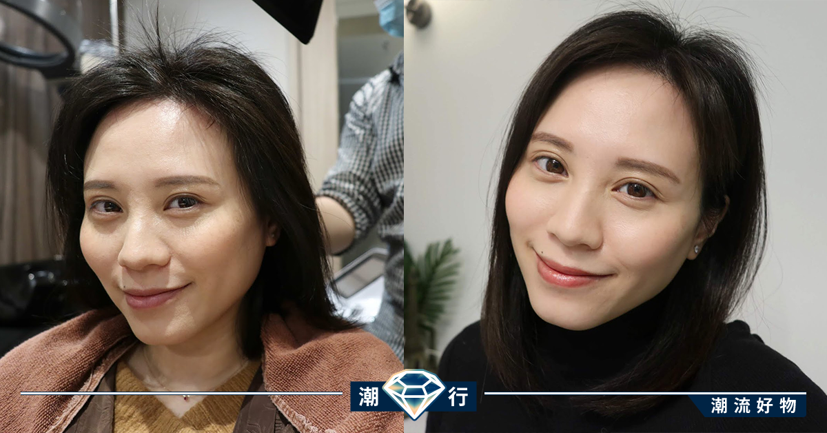 【媽媽的產後脫髮煩惱】真正有效增髮療程！完美解決產後脫髮問題