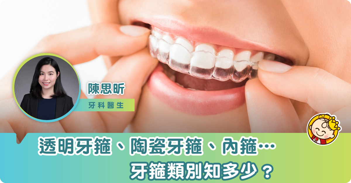 牙箍類別大不同