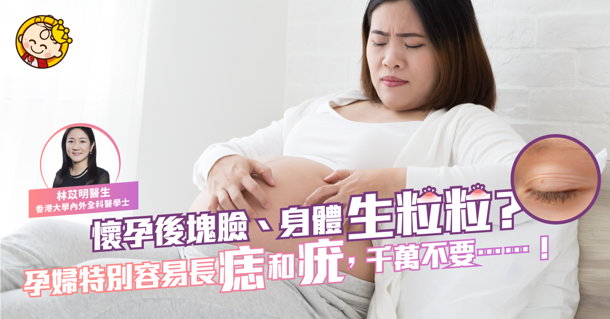 懷孕後身體出現好多顆粒，是痣還是疣？
