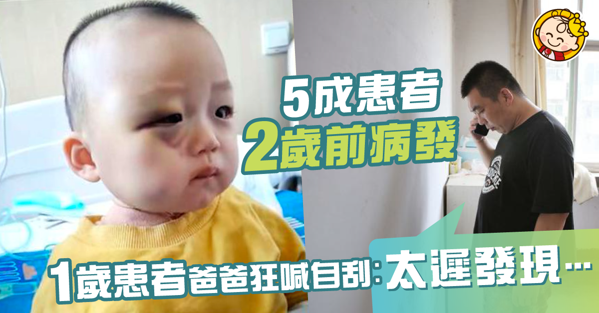 【兒童隱形殺手】及早發現神經母細胞瘤　腹腫眼腫係症狀！