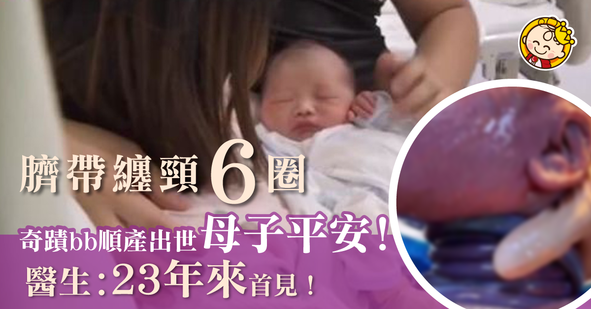 【奇蹟誕生】BB臍帶纏頸6圈順產出世　醫生解釋何為危險情況