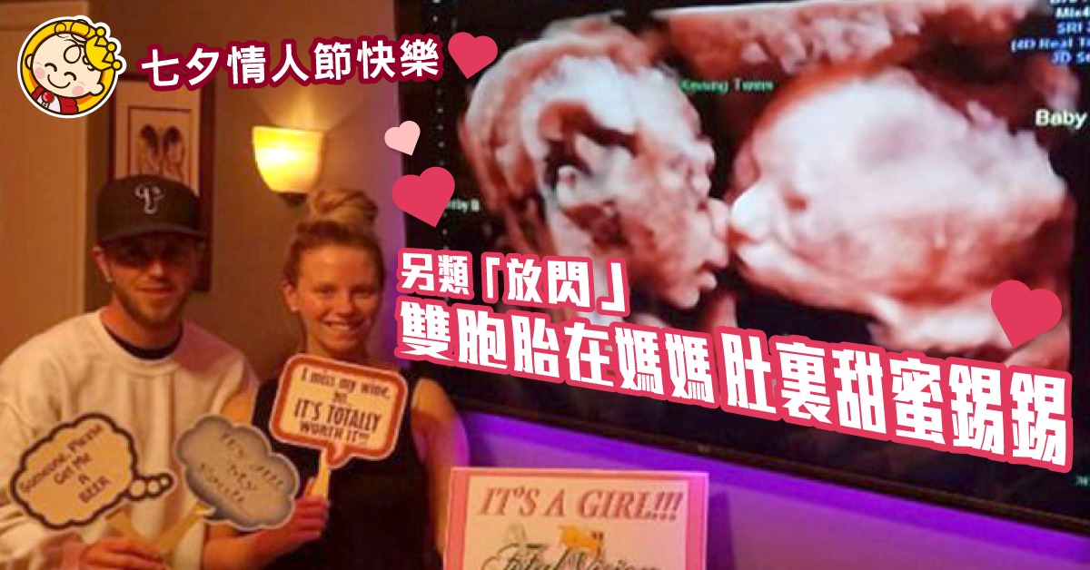【媽媽驚喜】超聲波檢查 顯示雙胞胎在媽媽肚中甜蜜錫錫親吻
