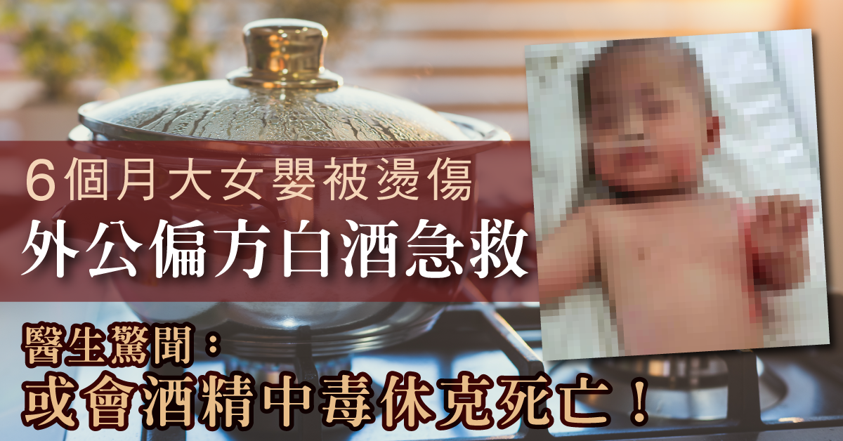 【家居意外】外公以白酒偏方治女嬰燙傷 醫生警告:恐酒精中毒(內含正確處理方法)