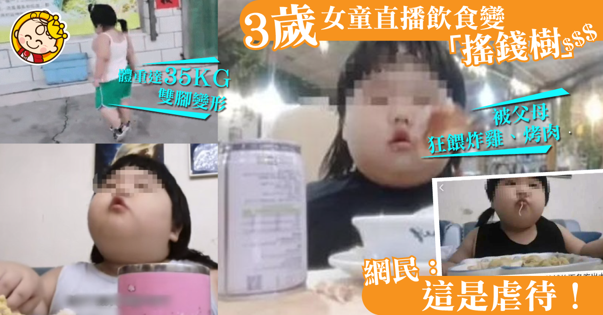 【虐兒？】3歲女變「搖錢樹」 被父母狂餵至35KG兼雙腳變形