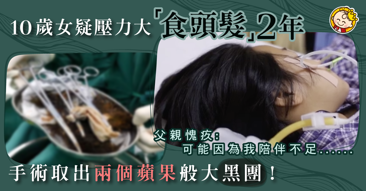 10歲女童疑壓力大「吃頭髮」2年  手術取出足足有2顆蘋果大的髮量