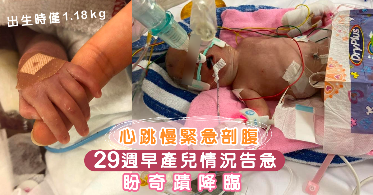 【生命小鬥士】29週早產兒與死神博鬥 父母集氣盼奇蹟降臨