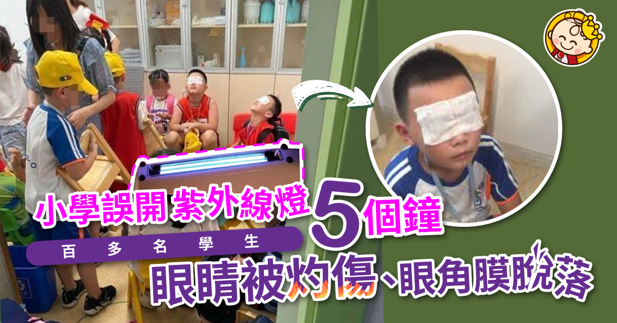 誤開5小時紫外線燈 百多名小學生眼睛被灼至眼角膜脫落