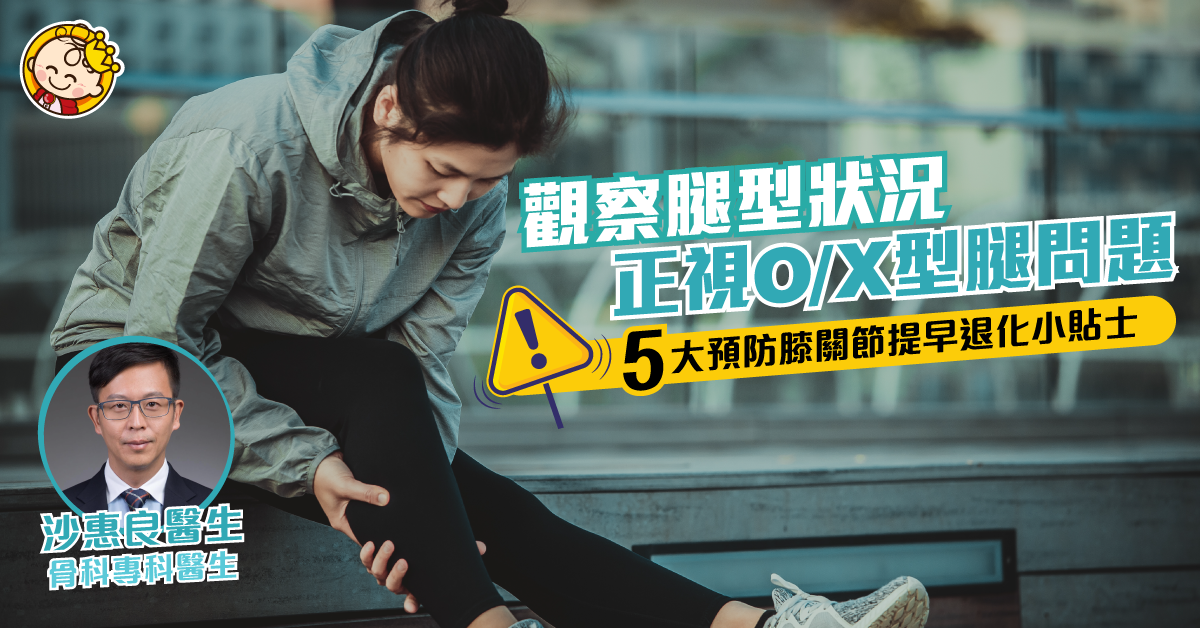 【改善腿型小知識】O/X型腿注意！強肌預防膝關節退化