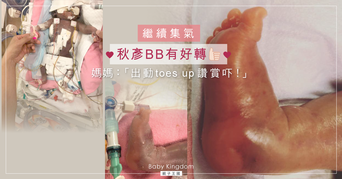【齊集氣】早產小秋彥情況好轉 媽媽：請繼續幫她大大力打氣