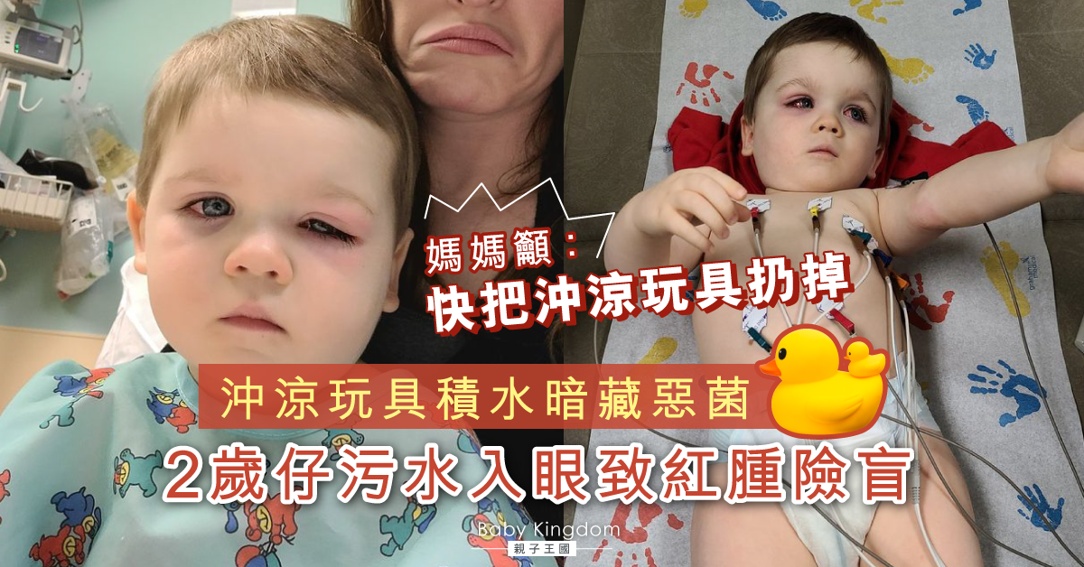 【育兒成長】沖涼玩具積水暗藏惡菌　2歲仔污水入眼險盲