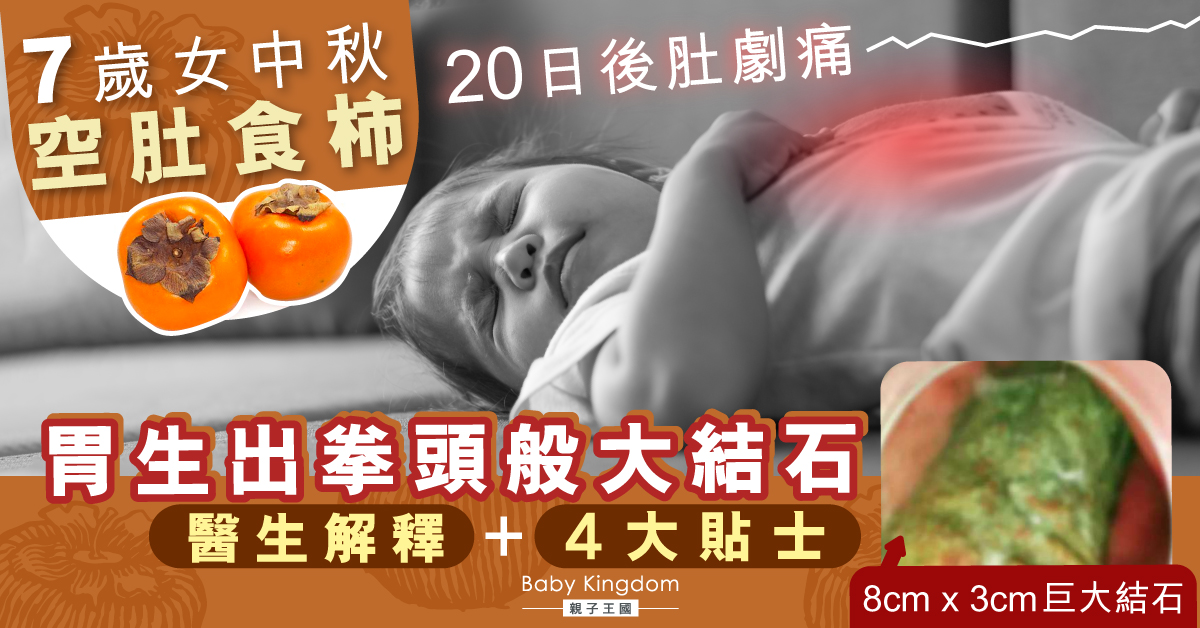 【飲食禁忌】7歲女空肚食柿 20日後肚劇痛 胃長出拳頭般大結石