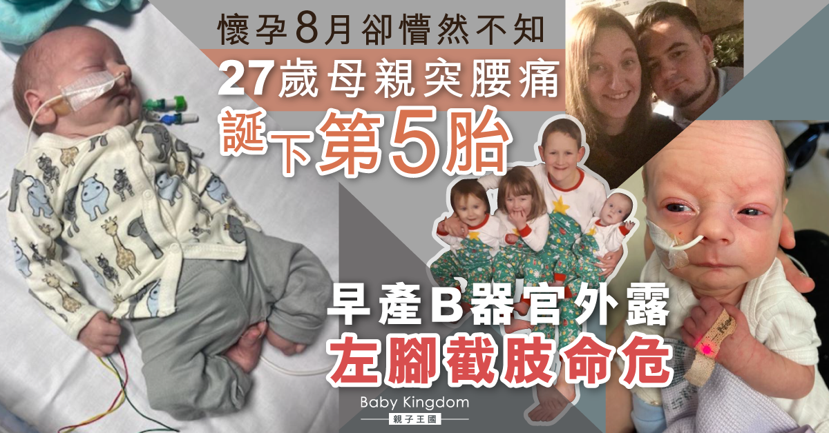 【大懵媽媽】27歲媽不知懷孕8月突腰痛產下第5胎 早產兒器官外露截肢命危