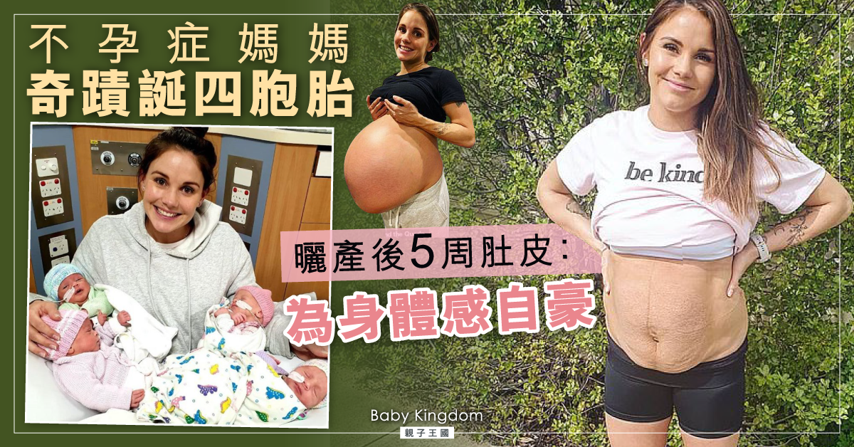 【生命奇蹟】不孕症媽媽平安誕四胞胎 產後5周曬鬆弛肚皮：我自豪