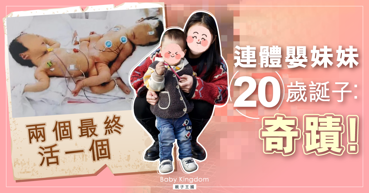 連體女嬰存活　飽歷大手術20年　奇蹟誕下健康男嬰！