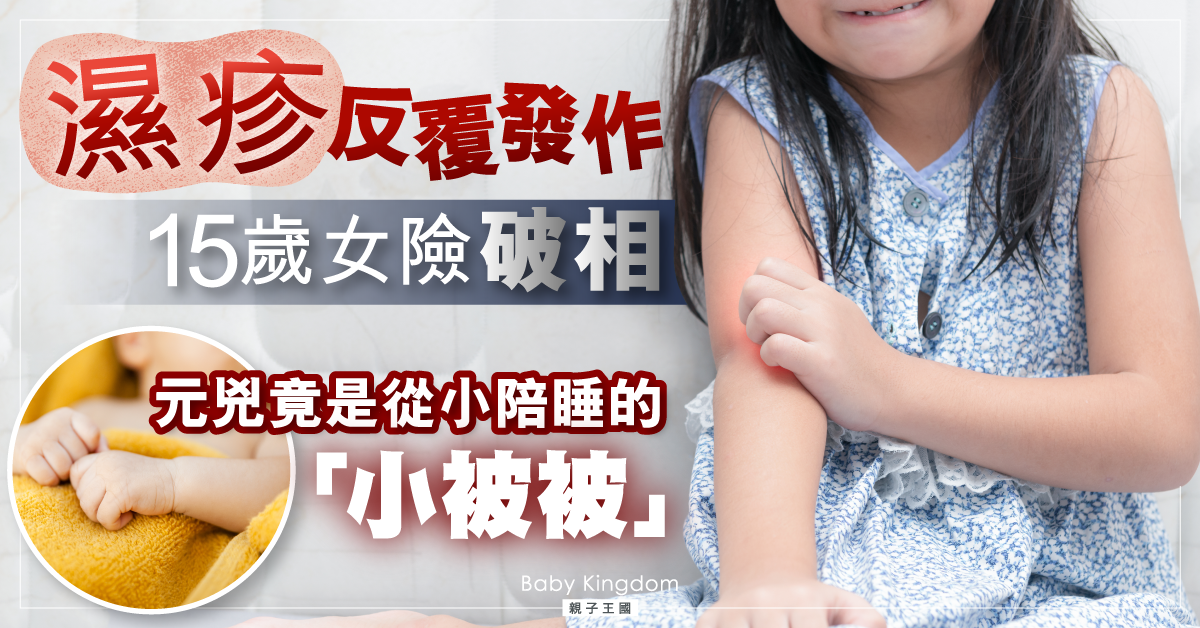 【戀物情結】15歲女濕疹反覆發作 元兇竟是兒時「小被被」