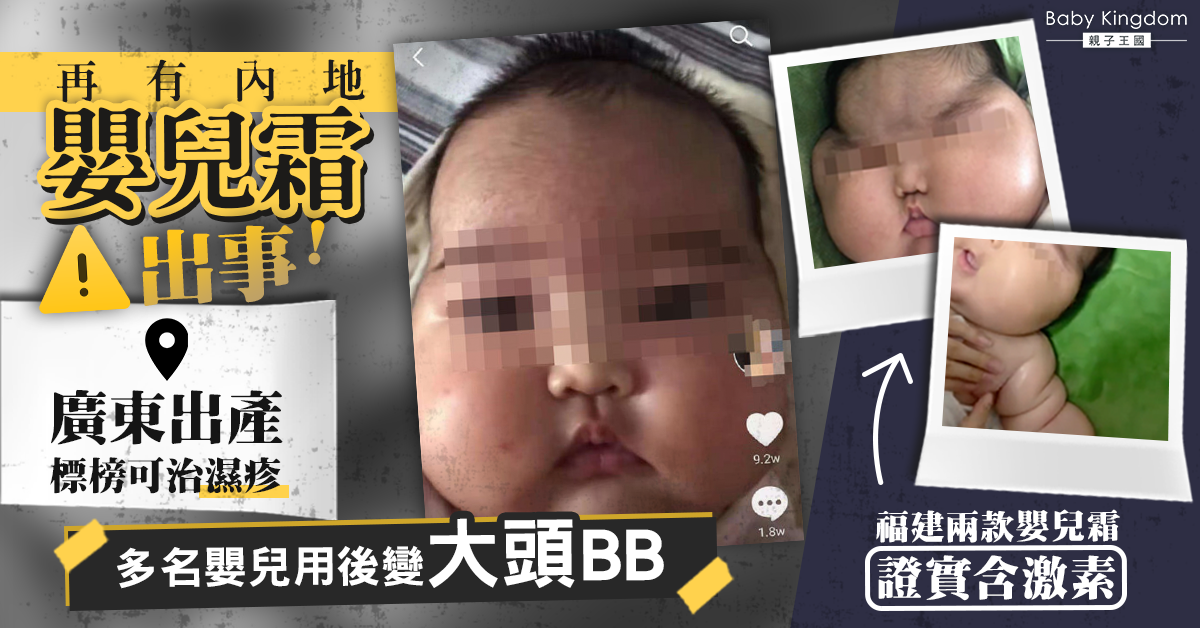 廣東出產嬰兒霜疑致大頭BB    用後現臉部腫大及多毛症狀