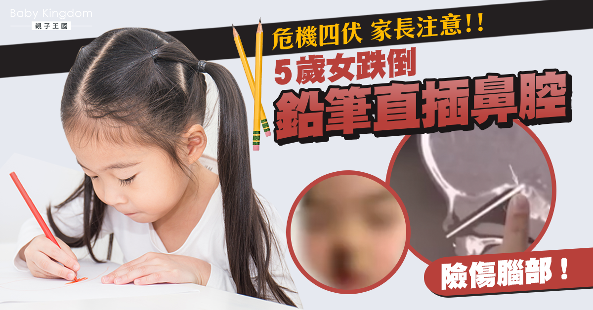 5歲女童玩耍不慎摔倒 鉛筆從鼻腔插入頭顱