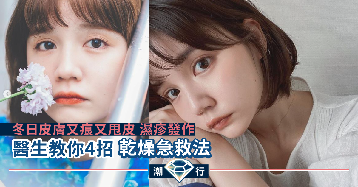 【親子急急問】冬日皮膚痕癢又甩皮致濕疹 醫生教你4招急救法