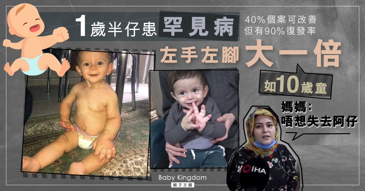【悲痛】1歲半仔患罕見病致左手腳大如10歲童 媽媽：不想失去他