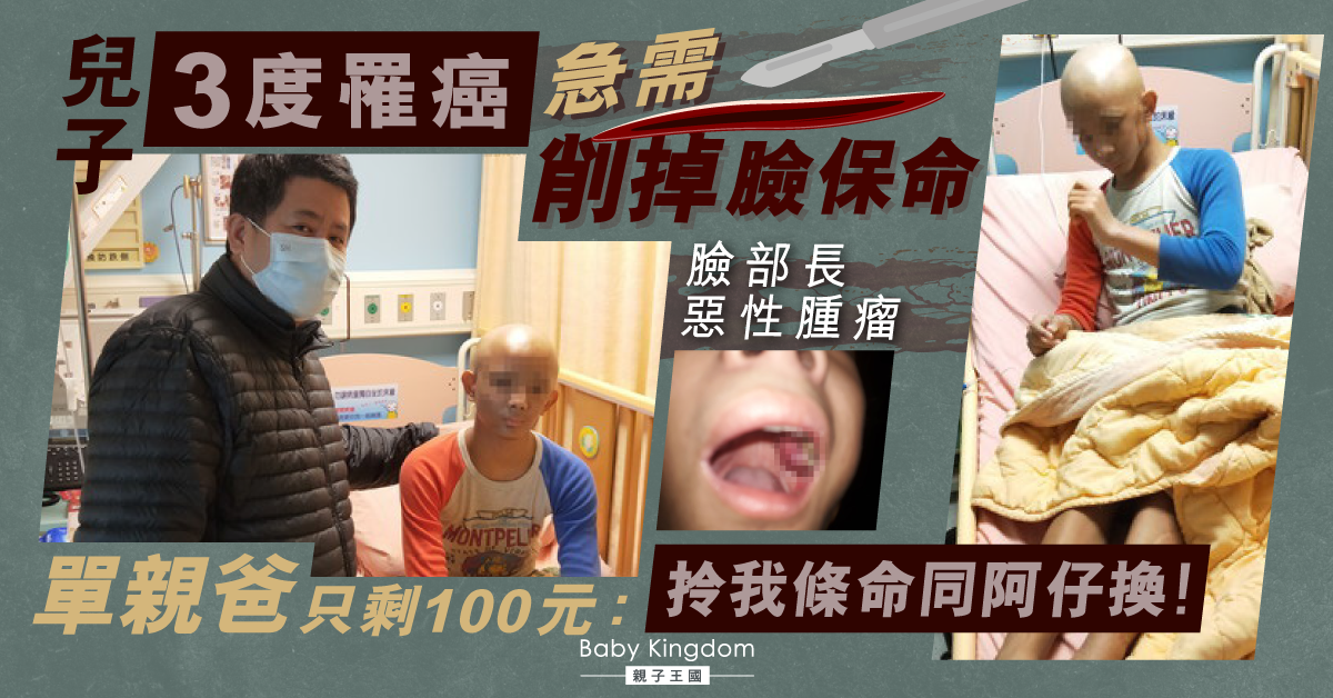 兒子3度罹癌需削臉保命 單親爸憾無法為兒受苦：拿我的命跟兒子換！