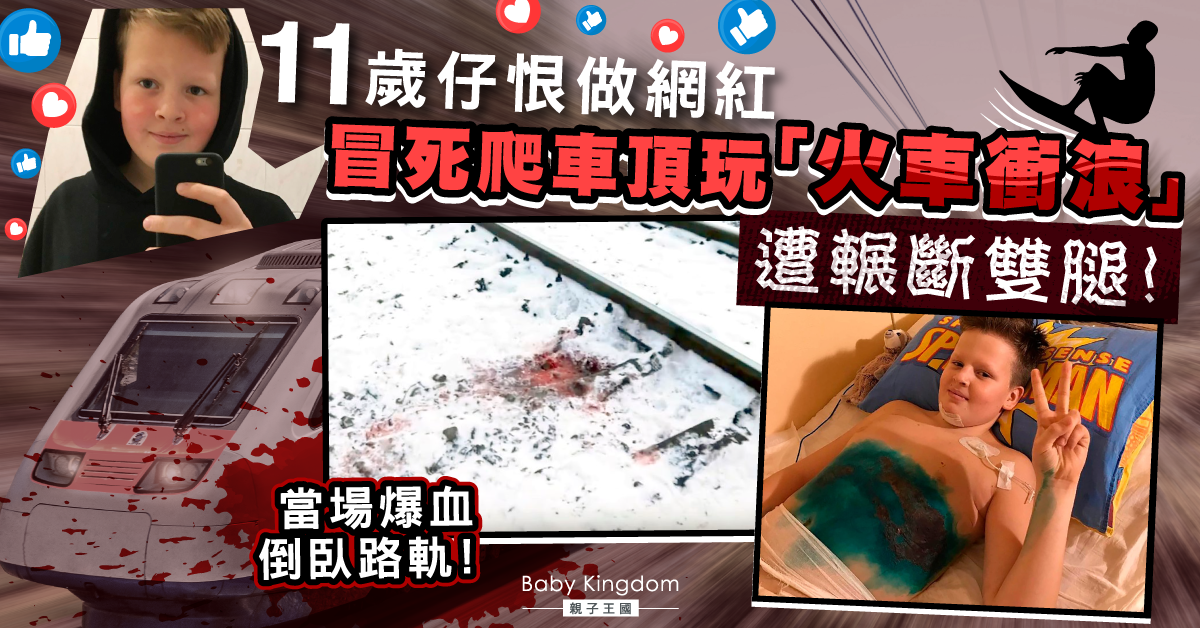 11歲男童為做網紅受朋友慫恿挑戰「火車衝浪」 意外摔下輾斷雙腿