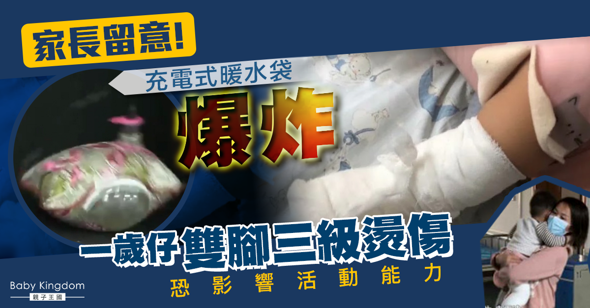【家居意外】充電式暖水袋爆炸 一歲仔雙腳三級燒傷