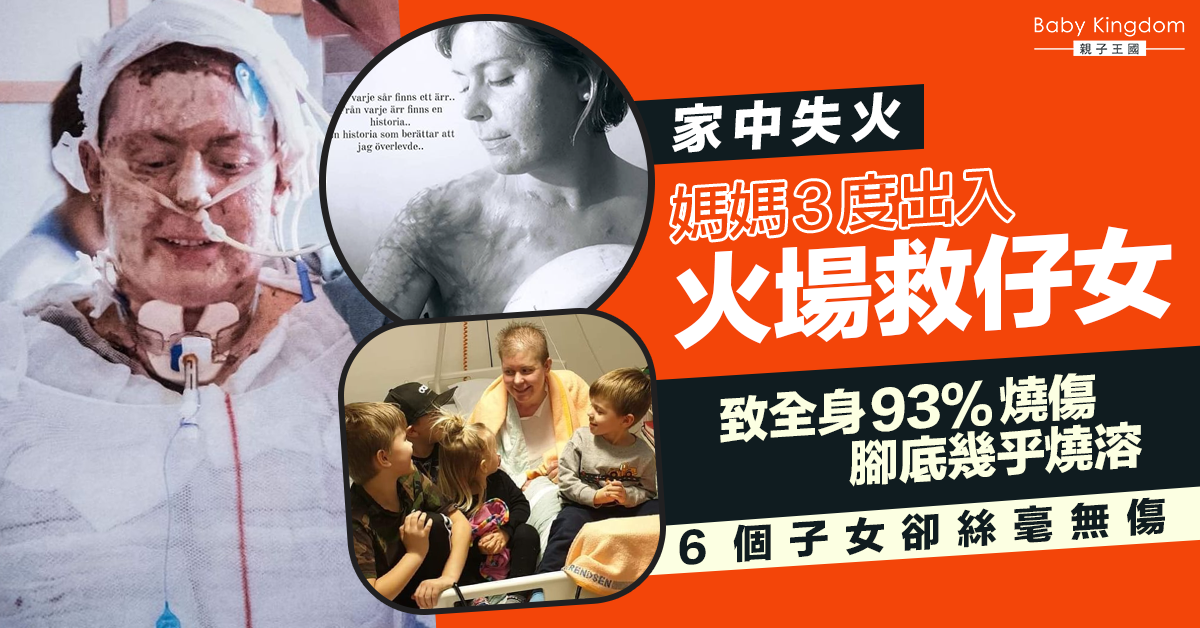 【偉大母愛】6孩之母為救孩子3度出入火場 致93%皮膚燒傷