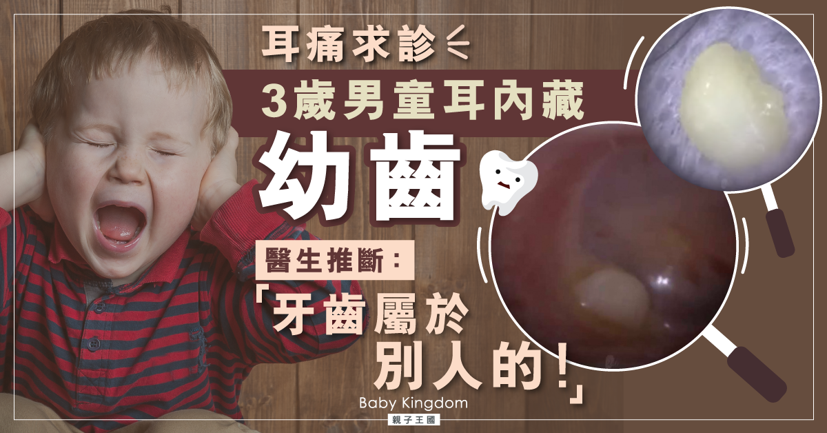 【耳朶長出牙?】英國3歲男童耳朵不舒服求診 驚揭內藏幼齒