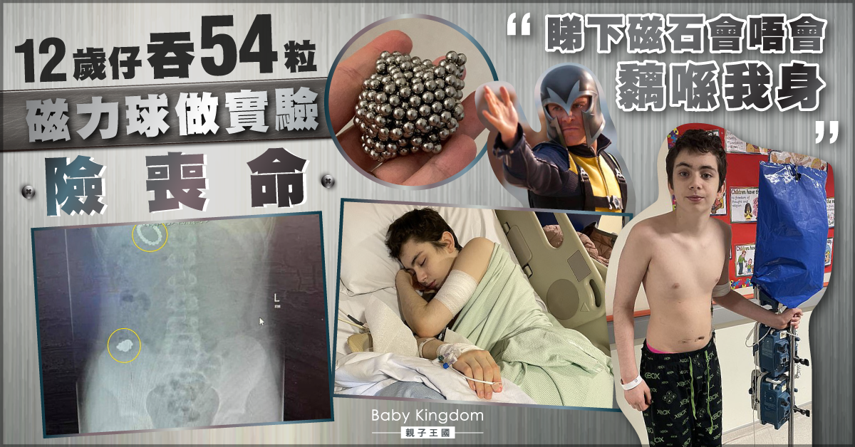 【家長注意】為測試身體能否有磁力 12歲仔吞54粒磁力球險喪命