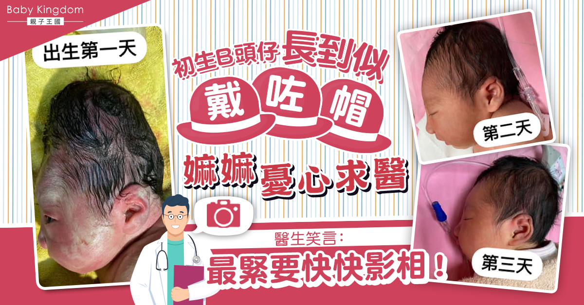 初生B頭型長到似戴咗帽嚇壞嫲嫲 醫生笑言：記得影相