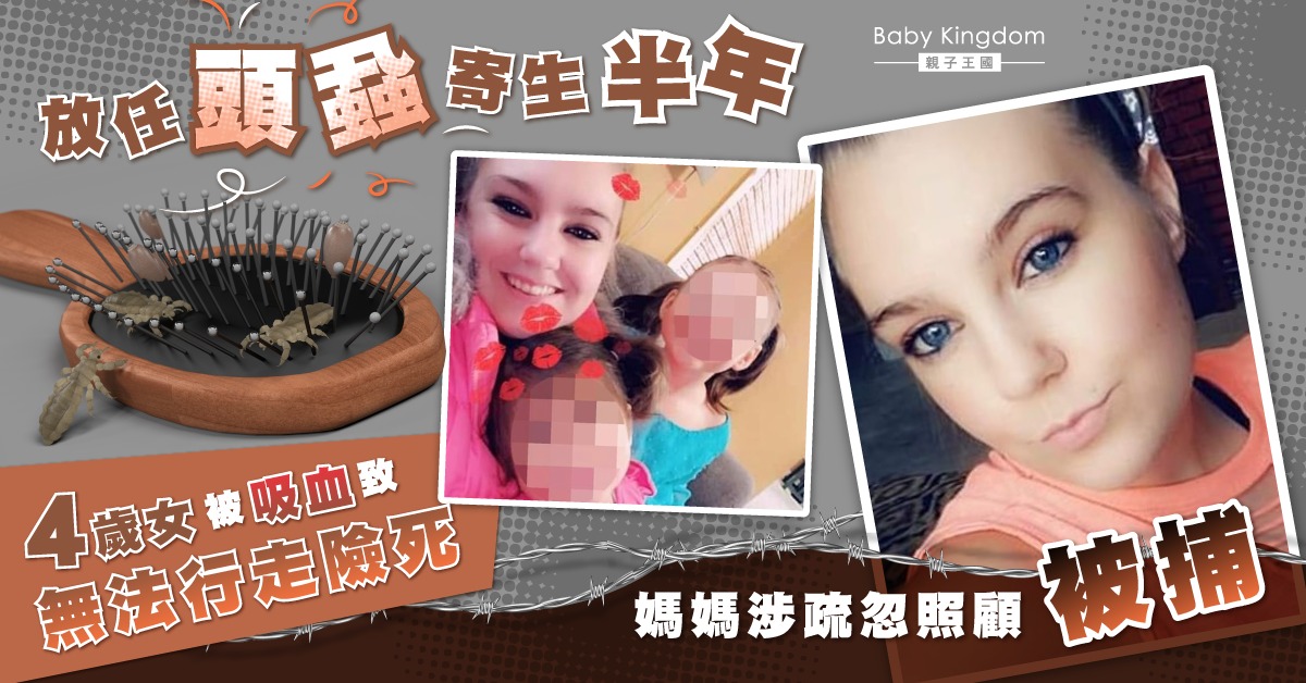 4歲女被頭蝨吸血致嚴重缺氧險死 母親涉疏忽照顧被捕