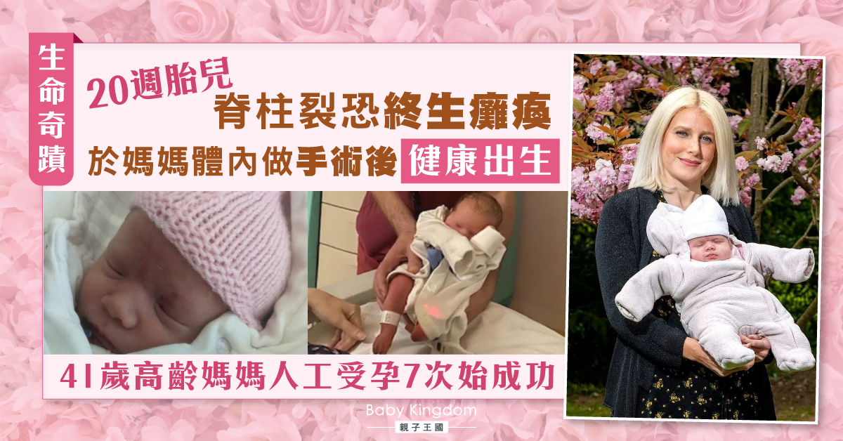 20週胎兒脊柱裂恐終生癱瘓 於母體內做手術終健康出生