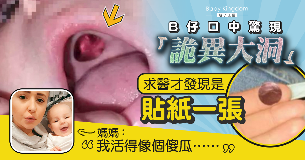 虛驚一場！10月大B仔口中現大洞　竟然是貼紙一張…