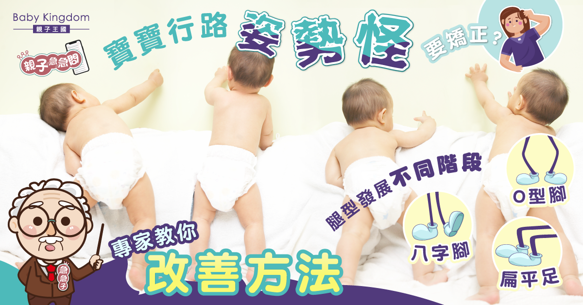 【親子急急問】行路姿勢奇怪要矯正？專家話你知寶寶腿型發展階段