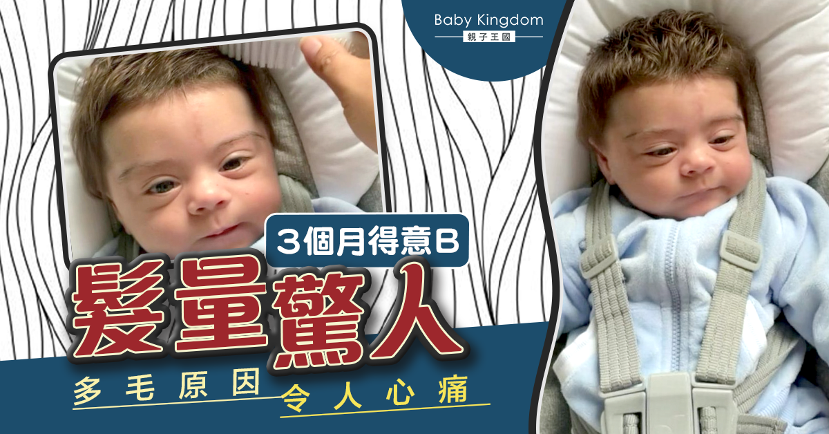 【多毛BB】3個月得意BB髮量驚人 多毛背後藏心酸故事