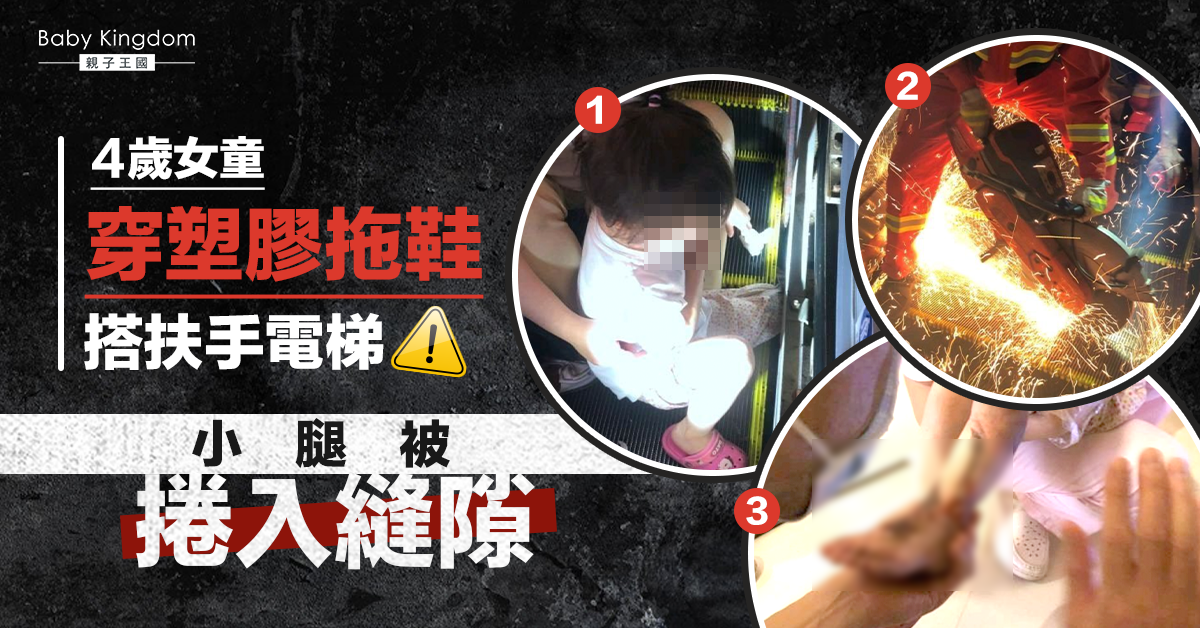 【家長注意】4歲女童穿塑膠拖鞋乘搭扶手電梯 小腿被捲入縫隙